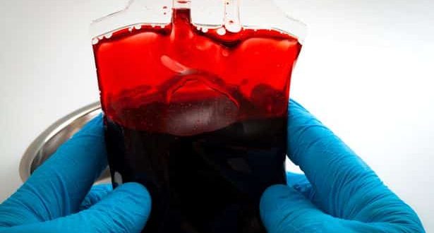 يصلح لكل فئات الدم.. علماء يابانيون يخترعون الدم الاصطناعي