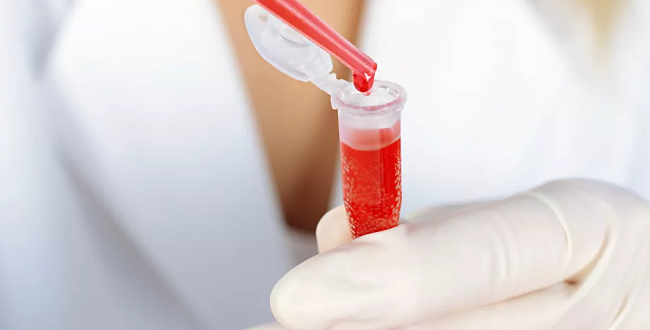 روسيا تكشف عن فصيلة الدم الأكثر عرضة للإصابة