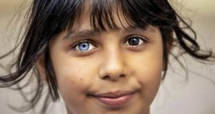 عينا طفلة سورية تشعل مواقع التواصل
