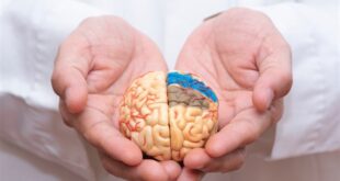 ما الذي يسبّب السكتة الدماغية المفاجئة؟