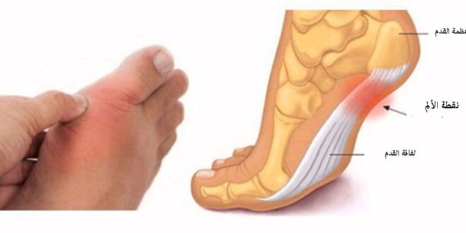 11 عارضاً في قدميكم يخبركم عن ضغط الدم والغدة الدرقية والتهاب المفاصل وأمراض أخرى