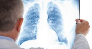 ما هي الأمراض التي تؤدي إلى الصعوبة في التنفس