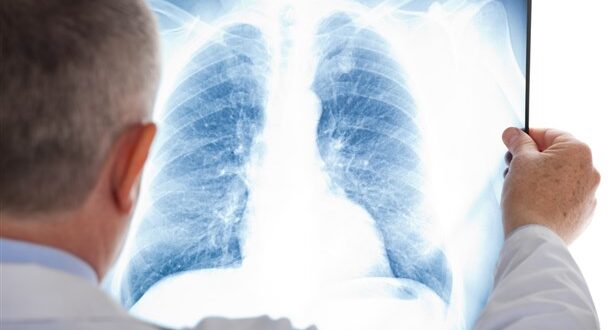 ما هي الأمراض التي تؤدي إلى الصعوبة في التنفس
