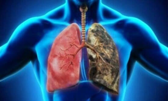 وصفة طبيعية لتنظيف الرئتين من السموم وخاصة للمدخنين