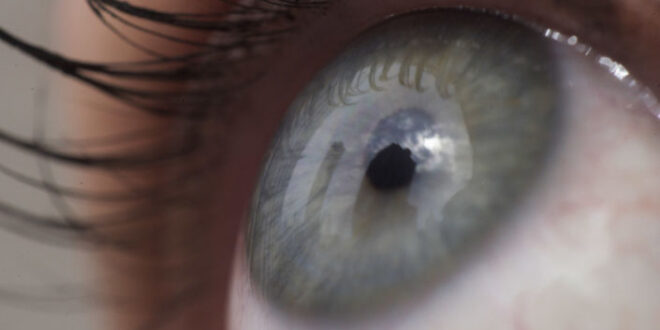 ثلاثة أعراض تصيب العين تكشف عن الإصابة بسرطان الرئة