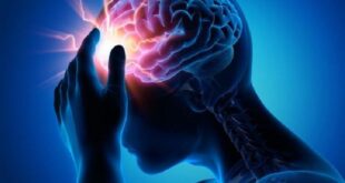 دراسة تكشف سببا غير متوقع لـ السكتة الدماغية