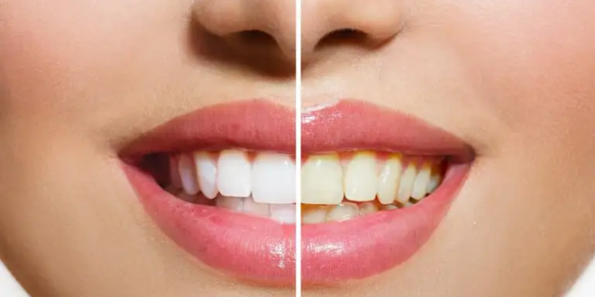 غير الفرشاة والمعجون.. حيل مدهشة لحماية الأسنان من الاصفرار