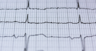 العلامات الأقل شهرة للنوبة القلبية الخطيرة
