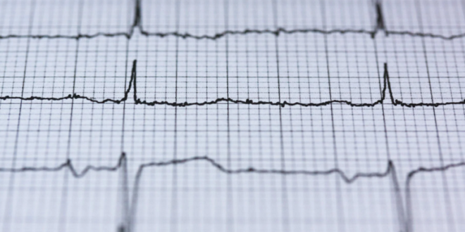 العلامات الأقل شهرة للنوبة القلبية الخطيرة