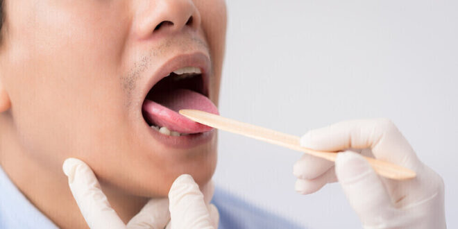 علامات تحذيرية "داخل الفم" لمستويات فيتامين B12