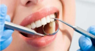 ما هي حشوات الأسنان المؤقتة