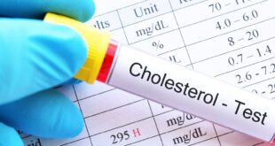 عادات ترفع مستوى الكوليسترول في الدم