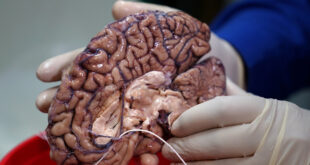 عالم روسي يكشف طرقا لإبطاء شيخوخة دماغ الإنسان