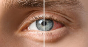 أمراض العين الـ 12 التي يجب الحذر منها