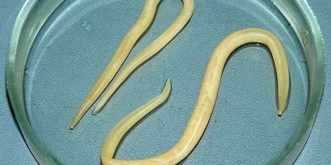 عدوى دودة الاسكارس Ascariasis