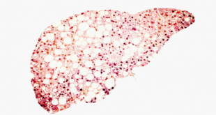 علامة تحذير في بطنك قد تدل على مرض الكبد الدهني!