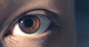 أعراض تتعلق بالعين يمكنها الكشف عن الارتفاع المقلق لضغط الدم