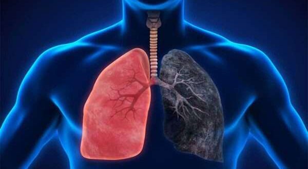 علاج ضيق التنفس بسبب التدخين