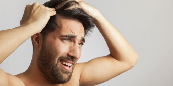 وصفات طبيعية لعلاج قشرة الشعر بسهولة
