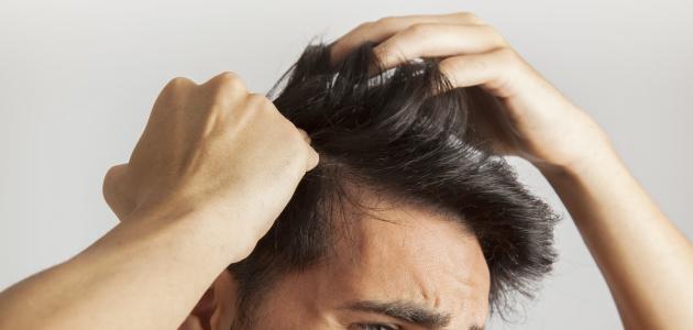 أفضل طريقة لعلاج قشرة الشعر نهائياً