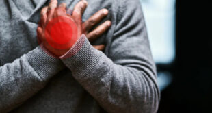 ذوو البشرة السمراء أكثر عرضة للإصابة بفشل القلب