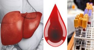 سرطان الكبد بناء على قطرة دم واحدة